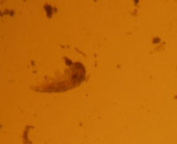 Pic 4: Sample view of tardigrade from observation scope. Tardigrade present.